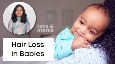 Hair Loss in Babies 👶 | Reasons & Tips to avoid Infant Hair Loss 12 1690025888 maxresdefault