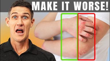 5 Ways to Make Psoriasis Worse | Reverse Engineering Psoriasis 10 1690033297 maxresdefault