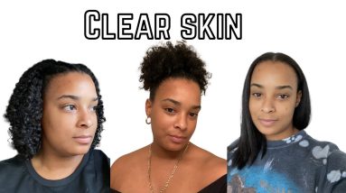 How to achieve Clear Skin 16 1690035714 maxresdefault