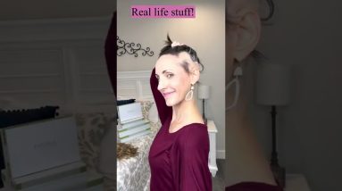 Alopecia! #shorts 12 1690049260 maxresdefault