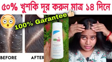 "Sebamed Anti-Dandruff Shampoo | | pH 5.5 | Confirmed results | Reduces dandruff |#pHmatters" 18 1690105565 maxresdefault