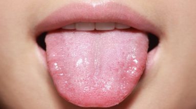Do Not Ignore These 5 Warning Signs Of Unhealthy Gut 8 1690285757 maxresdefault