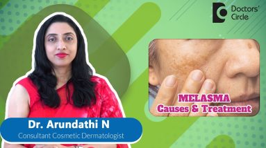 Treat Darks Spots or Patches on Face | MELASMA #pigmentation - Dr. Arundathi N | Doctors' Circle 16 1690286723 maxresdefault