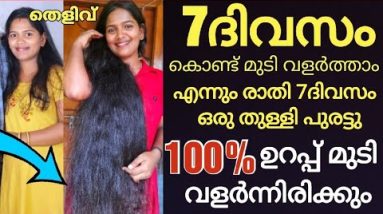 ഒരിക്കലും ഇനി എനിക്ക് മുടി വളരില്ല എന്ന് വിചാരിച്ചിരുന്ന എനിക്ക് മുടി വളർന്നത് ഇങ്ങനെ...100%ഉറപ്പ് 8 1690291807 hqdefault
