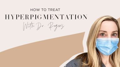 The Secret to Treating Hyperpigmentation! 2 1690389258 maxresdefault
