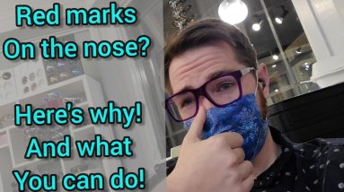 -Beauty Hack to Prevent Red Marks On Nose From Glasses! Stop Red Mark From Glasses! 6 1690463315 maxresdefault