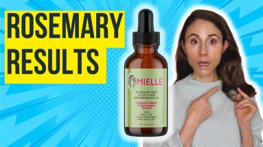 Does ROSEMARY OIL WORK FOR HAIR GROWTH? 🤔 Dermatologist @DrDrayzday 20 1690633508 maxresdefault