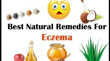 Best Natural Home Remedies for Eczema 4 1690707084 hqdefault
