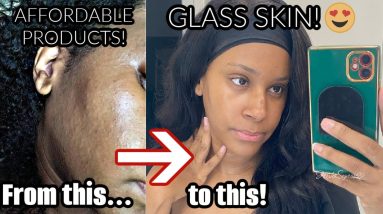 HOW I CLEARED MY SKIN IN 4 WEEKS! | HOW I CLEARED MY SKIN TEXTURE & PRODUCTS USED | JUST JERIKA 16 1690710267 maxresdefault