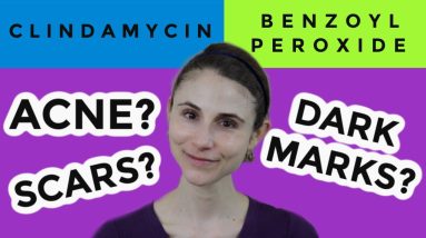 Clindamycin versus benzoyl peroxide for acne| Dr Dray 6 1690715993 maxresdefault