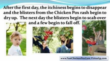 chicken pox in infants - chicken pox treatment 6 1691072661 hqdefault