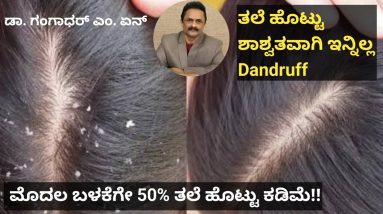 ತಲೆಹೊಟ್ಟು ತೆಗೆದುಹಾಕುವುದು ಹೇಗೆ?? 4 1691155995 maxresdefault