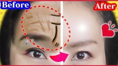 Resting the Temple in Palm will Remove Eye Wrinkles and Uplift the Whole Eye Area 6 1691334438 hqdefault