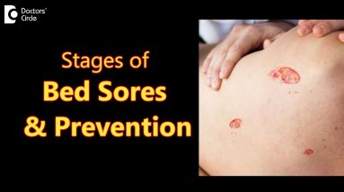 BED SORES (DECUBITUS ULCERS): Stages, Causes, Symptoms & Treatment-Dr.Aruna Prasad | Doctors' Circle 14 1691479702 maxresdefault