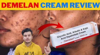demelan cream review | jhaiya hatane ki cream | pigmentation removal cream 6 1691499557 maxresdefault