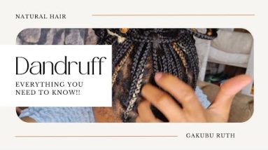 How to Dandruff: Causes and Treatment!! #dandruff #dandruffcontrol #trending 14 1691600333 hqdefault