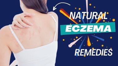 Get the Skin You Deserve: 8 Natural Remedies to Help Cure Eczema 6 1691932397 maxresdefault