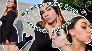 my acne came back & starting accutane 10 1692005058 hqdefault