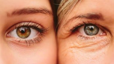 Resting the Temple in Palm will Remove Eye Wrinkles and Uplift the Whole Eye Area 12 1692046097 hqdefault