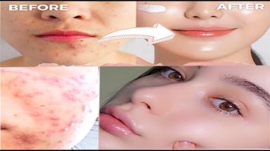 Simple Summer Skincare - Ultimate Guide to Facial Skin Care only in few steps | | Art Gallery 4 1692259748 hqdefault