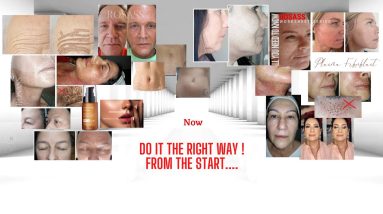 "How to Up Lift the Standards of Plasma Fibroblast" 18 1692384255 maxresdefault