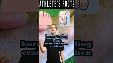 Athlete's Foot Fungus: The Itchy, Scaly Truth! 8 1692386756 maxresdefault
