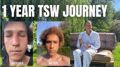 HOW ECZEMA MEDICATIONS DESTROYED MY SKIN, a year-long journey with dry skin (TSW) 20 1692460212 maxresdefault