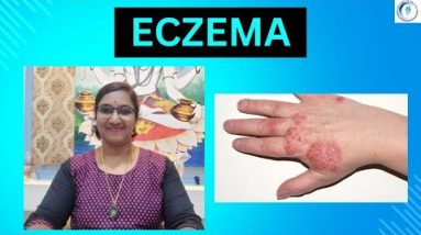 Acupressure Treatment for Eczema (in #kannada) #eczema #dermatitis #skincare 16 1692461294 hqdefault