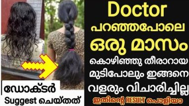 Doctor പറഞ്ഞപോലെ ഇങ്ങനെ ചെയ്താൽ തീർച്ചയായും എത്ര വളരാത്ത മുടിയും വളർന്നിരിക്കും🔥😱വാക്കല്ല ഗ്യാരണ്ടി 4 1692483302 hqdefault