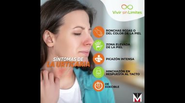 Síntomas de la Urticaria 20 1692531020 maxresdefault