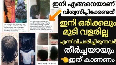 (തെളിവ് സഹിതം)ജനഞങ്ങളെ ഞെട്ടിപ്പിച്ച മാറ്റം🔥ഒരിക്കലും വളരില്ല എന്ന് വിചാരിച്ച മുടിപോലും വളർന്നത്☝️ 18 1692644844 hqdefault