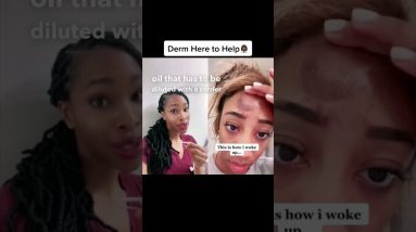 Tea Tree Oil and Skin Care: The Risks You Need to Know 8 1693514969 maxresdefault