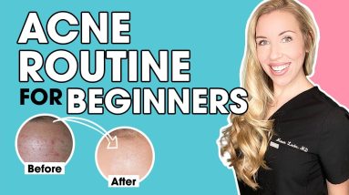 Acne Skincare Routine for Beginners | The Budget Dermatologist 8 1693757018 maxresdefault