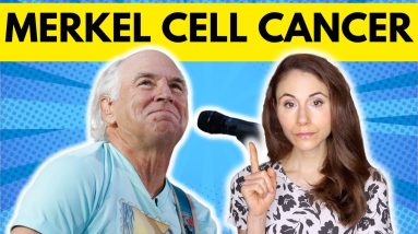 Merkel Cell SKIN CANCER EARLY SIGNS NOT TO MISS 14 1694797457 maxresdefault