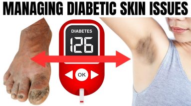 Diabetes Skin Care: Managing Skin Conditions for a Healthier Life | Skin Health Tips for Diabetics 12 1694852718 maxresdefault