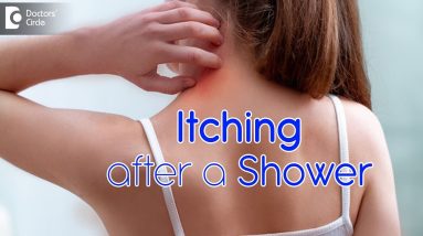 Body itching after a bath - Causes & Remedies - Dr. Rashmi Ravindra | Doctors' Circle 20 1695355680 maxresdefault