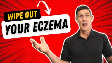 How We Cleared Eczema for Our Baby Boy Naturally 18 1699536064 maxresdefault