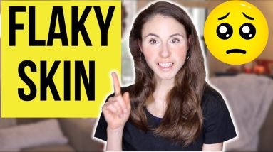7 Reasons Why Your Skin Is Flaky & How To Fix It 10 1699596337 maxresdefault