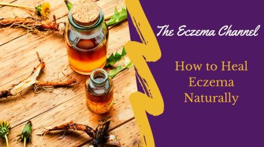 How to Heal Eczema Naturally 18 1699657138 maxresdefault