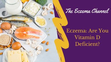 Eczema: Are You Vitamin D Deficient? 12 1699719593 maxresdefault