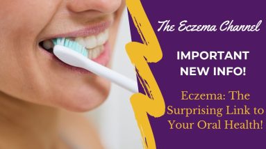 Eczema The Surprising Link to Your Oral Health 14 1699937001 maxresdefault