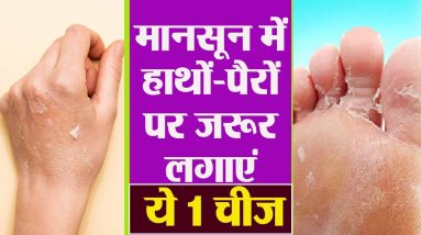 Monsoon में हाथों-पैरों की उतर रही है Skin तो तुरंत करें ये काम | Boldsky 2 1700717461 maxresdefault