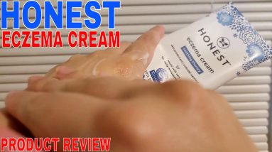✅ Honest Eczema Cream 🔴 20 1701673808 maxresdefault