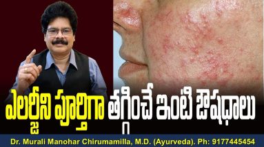 ఎలర్జీని పూర్తిగా తగ్గించే ఇంటి ఔషధాలు | Home remedy for Allergy in telugu. #facts 4 1702450324 maxresdefault