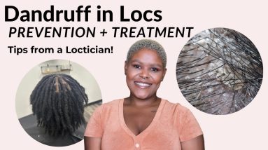 Dandruff & Locs: A Guide to Clean Scalp | Loctician Tips 20 1703211274 maxresdefault