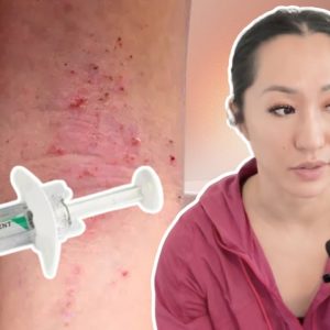 1764988542 maxresdefault