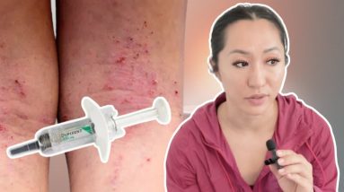 1764988542 maxresdefault