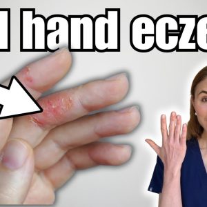 1764989456 maxresdefault