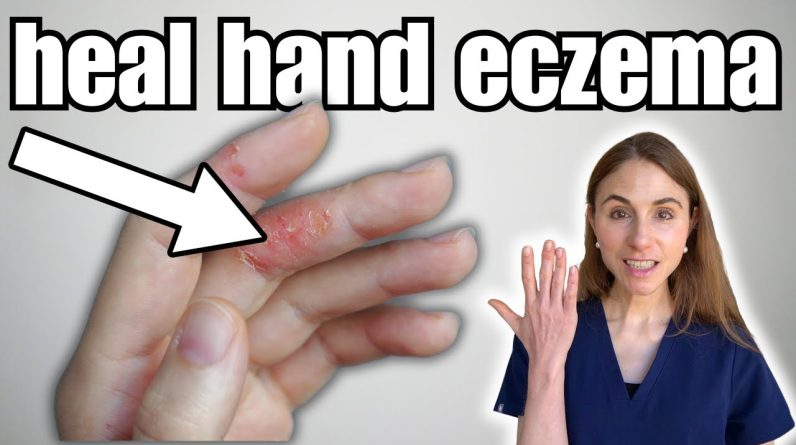 1764989456 maxresdefault