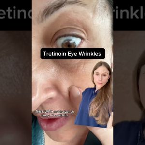 1764994010 maxresdefault